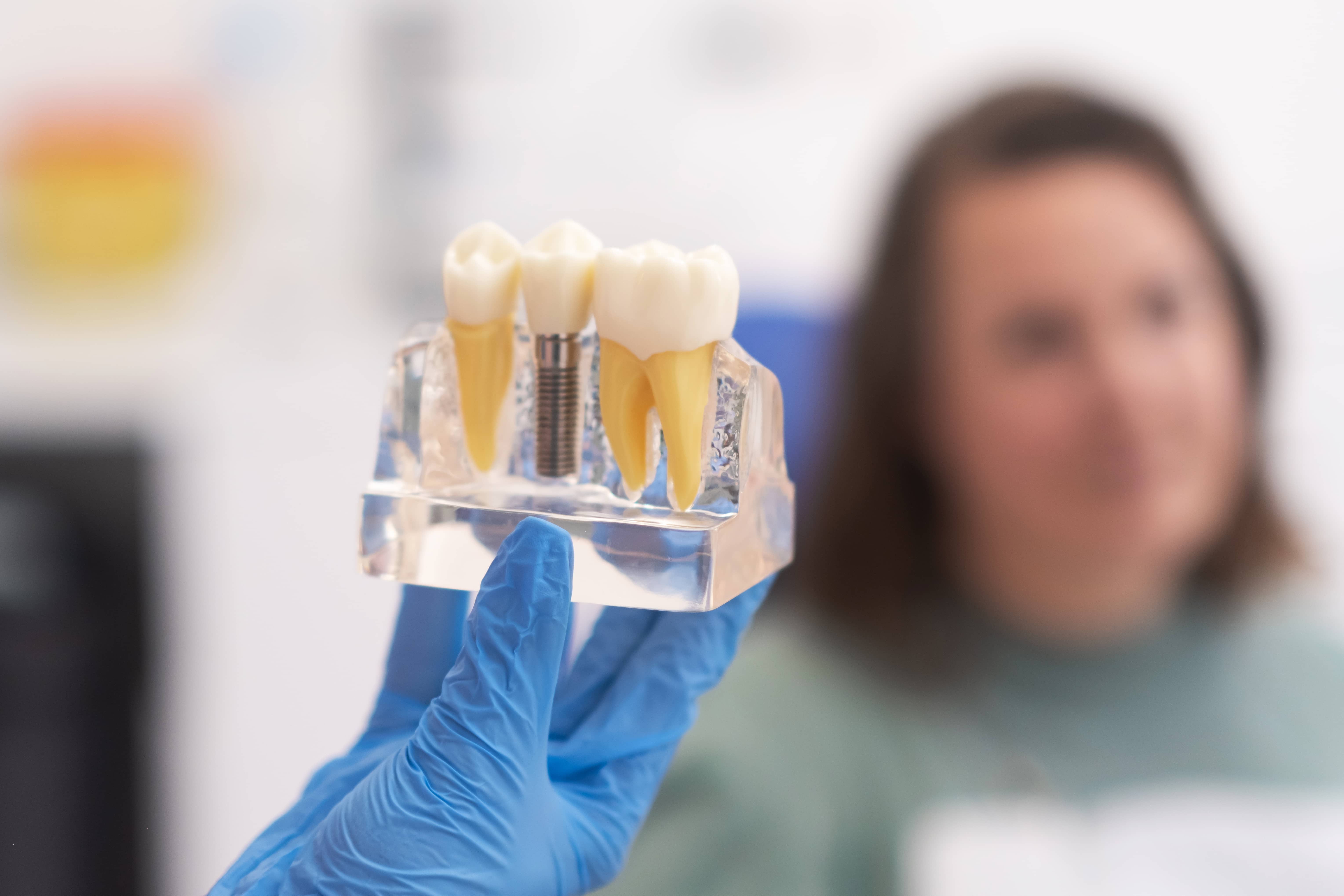 Periodontoloji Nedir?