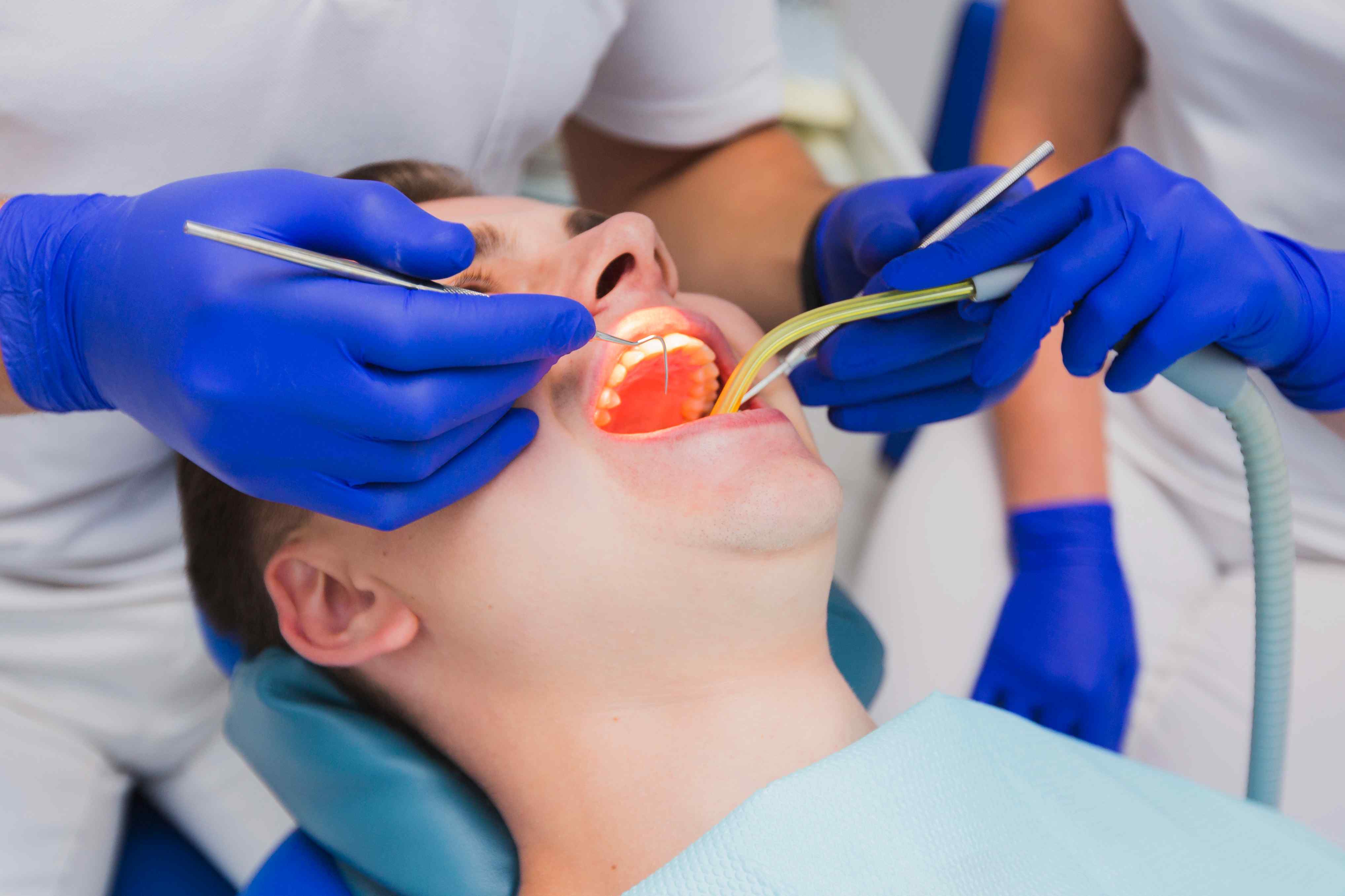 Diş Eti Hastalıkları Periodontoloji