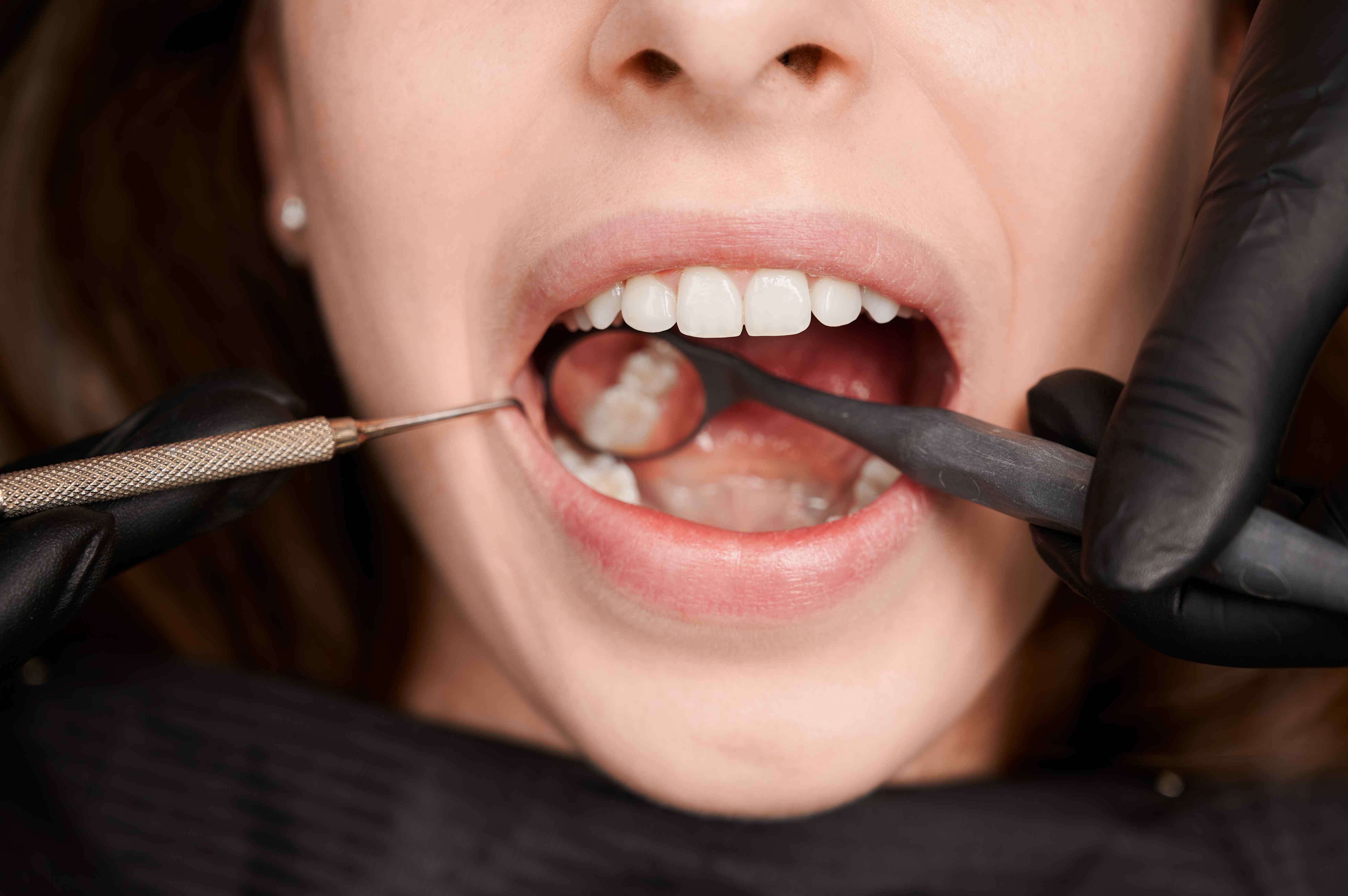 Periodontoloji Ne Demek?
