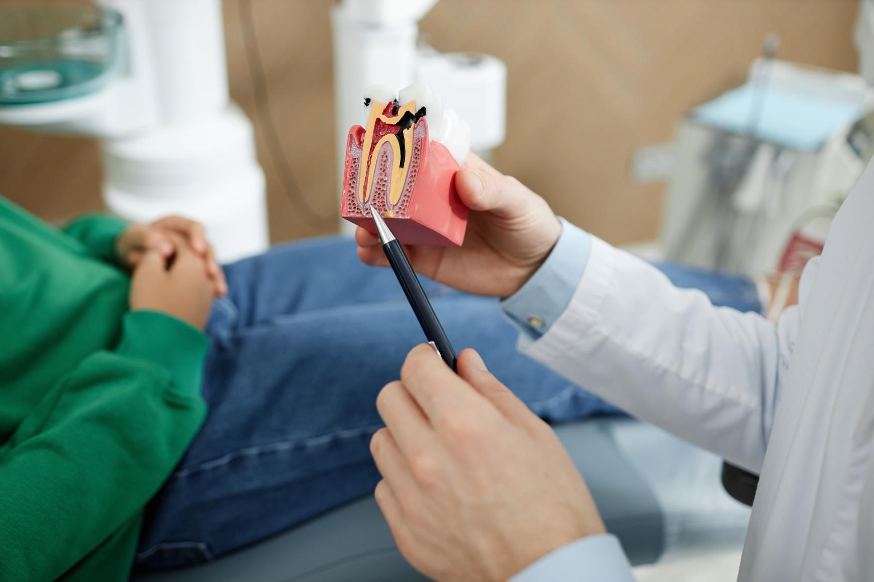 Endodonti Kanal Tedavisi Fiyatları