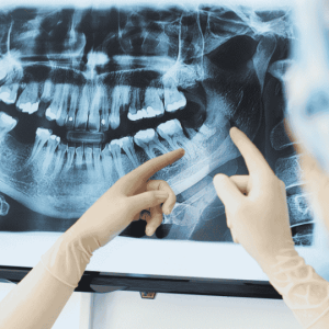Oral Diagnoz Ne Demek?