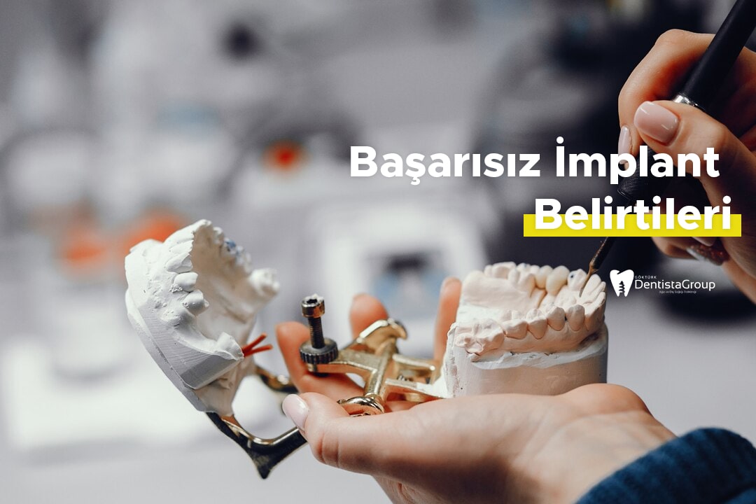 Başarısız İmplant Belirtileri