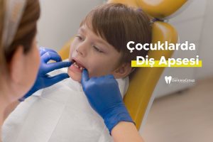 Çocuklarda Diş Apsesi