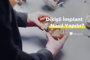 Dikişli İmplant Nasıl Yapılır?