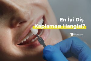 En İyi Diş Kaplaması Hangisi?