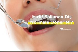 Hafif Sallanan Diş Normale Döner Mi?