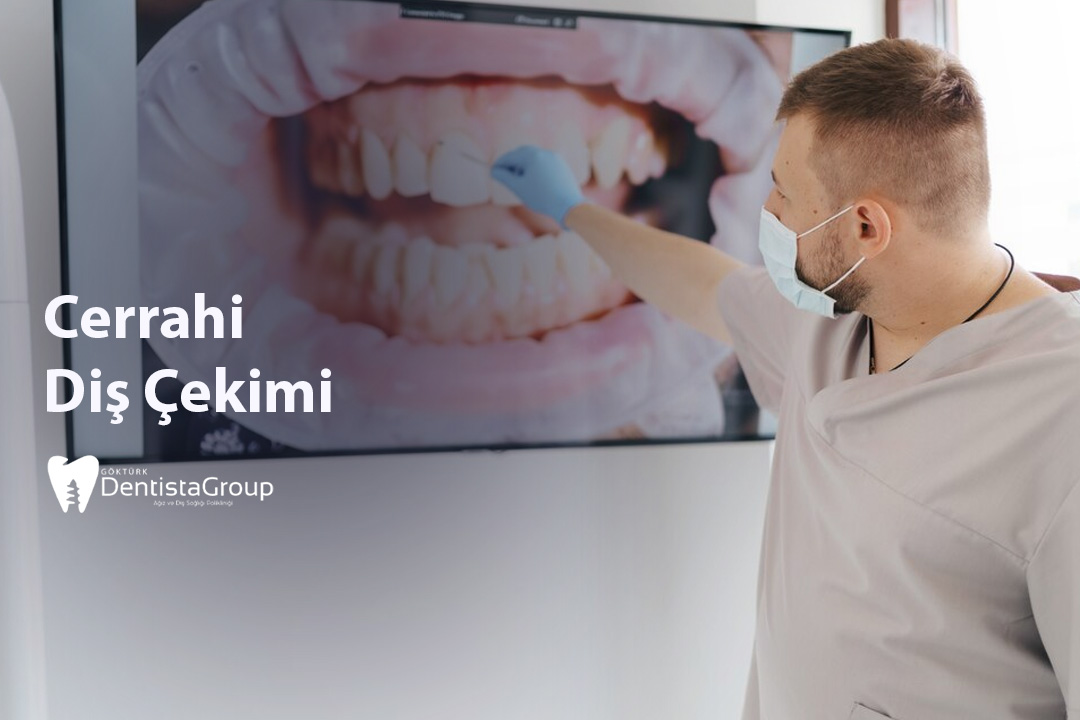 Cerrahi Diş Çekimi