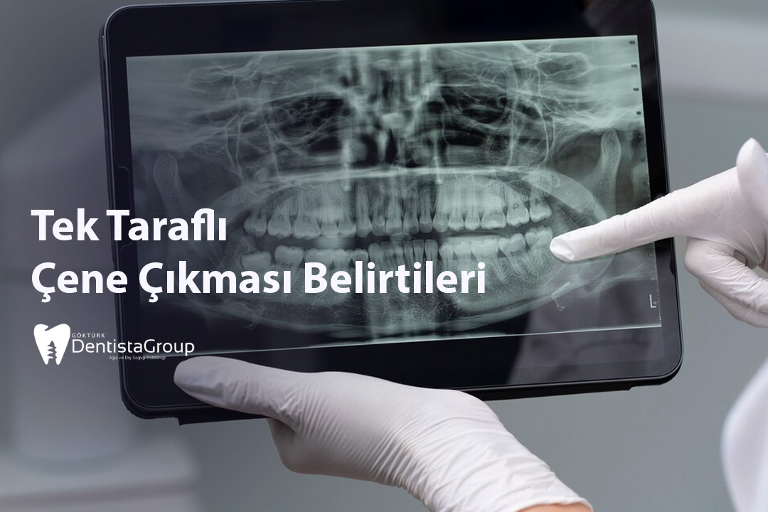 Tek Taraflı Çene Çıkması Belirtileri